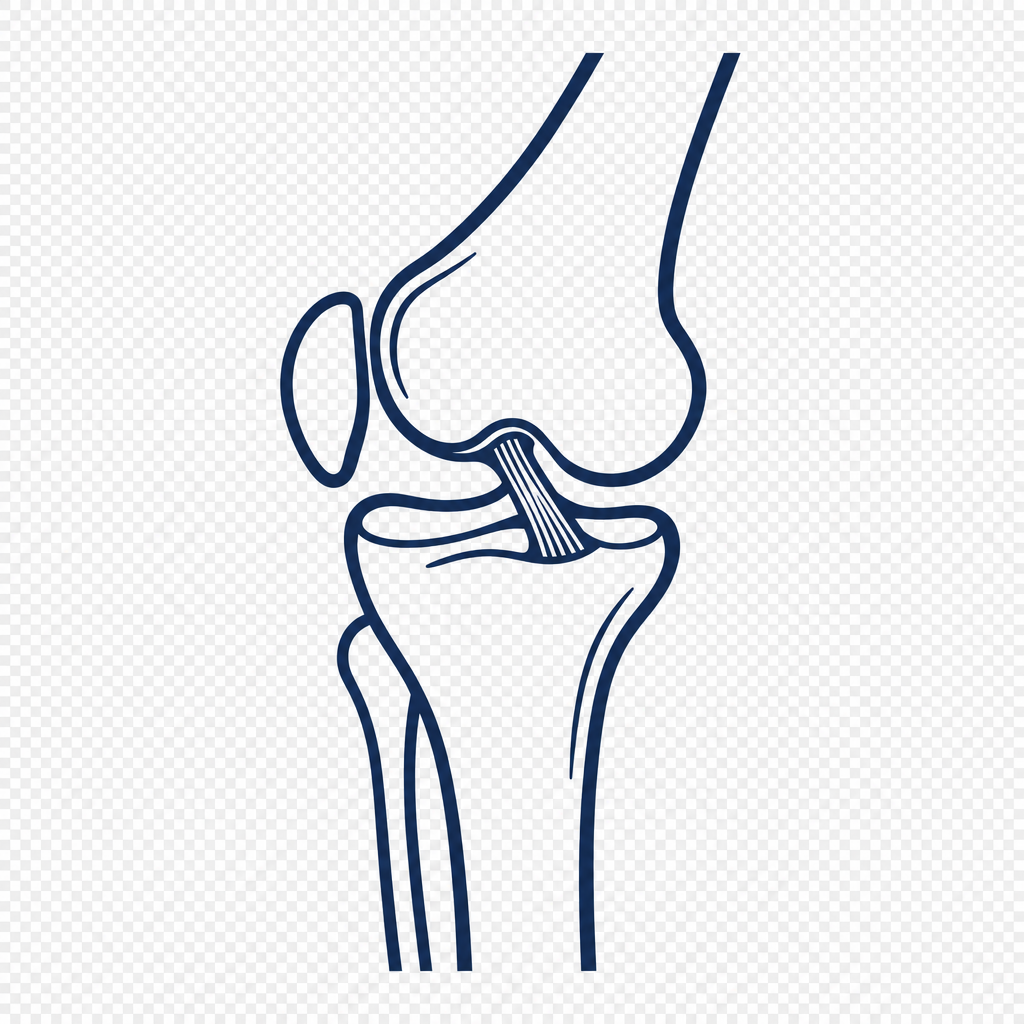 Anatomical illustration: When your knee still isn't right